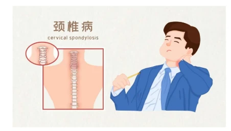 Về chứng mất ngủ? Bạn đã xem xét nguyên nhân của cột sống cổ chưa?
